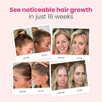 Trybello Hair Growth Shampoo | Natural Hair Thickening & Scalp Detox | Sulfate Free, Vegan, Anti-Hair Fall Formula | Caffeine, Aloe Vera, Turmeric, and Urucum Extract | For Any Hair Type