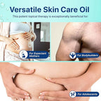 Stretch Mark Oil, Minimizes the Risk and Severity of Stretch Marks, Gentle Belly Oil for Pregnancy, Made of Natural Ingredients, Suitable for Adults and Children, 120mL（4.06 Fl Oz）