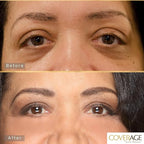 Jerome Alexander CoverAge Concealer Stick - Anti-Aging Under Eye Concealer + Skincare - Brighten Dark Circles, Hydrate, and Nourish - Medium Dark