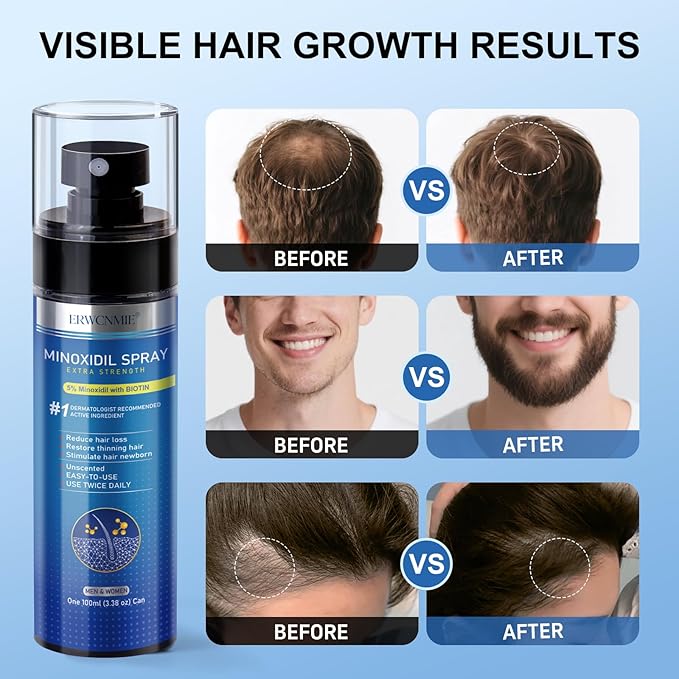 5% Minoxidil Spray for Men and Women-7 pack, Infused with Biotin, Beard Growth, Extra Strength Treatment to Combat Hair Loss and Thinning, and Fuller Hair & Beard (11 Month Supply, Extra Strength)