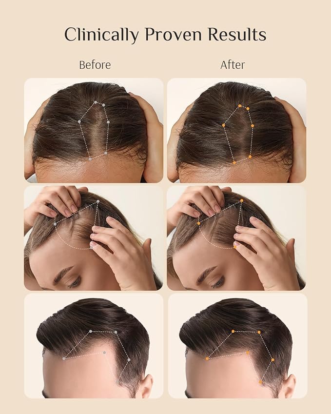 DR ZERO NEOLOGY Hair Growth Conditioner for Women, 13.5 oz, Volumizing Thickening & Anti Hair Loss Regrowth Treatment, Clinically Tested for Hair Thinning with Redensyl, Japanese Hair Care Products