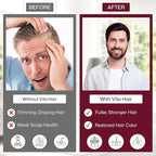 Vita Green Hair Growth Supplement (維新烏絲素) – Herbal Support for Thinning and Graying Hair – Naturally Simulates Follicles to Encourage Fuller, Healthier Hair – 90 Capsules