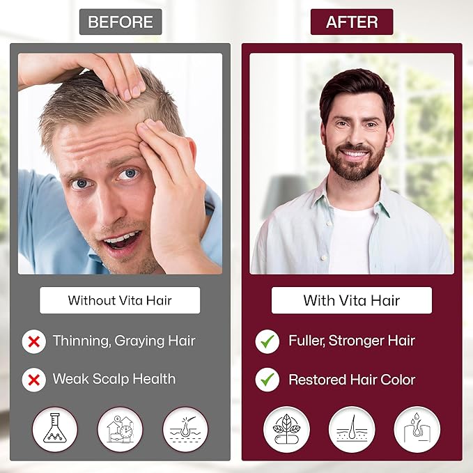 Vita Hair (Micronized Formula) Growth & Hair Loss Supplement – 100% Natural for Healthier Hair – Supports Hair Growth, Reduces Hair Loss, and Combats Graying for Men & Women – 300 Capsules