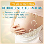 PEGO Stretch Mark Oil for Pregnancy, Maternity Body Oil for Stretch Mark Prevention & Reduction, Hydrating Skin Care, 4.06oz (2Pack)