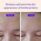 Blumbody Forehead Wrinkle Patches - Anti Wrinkle Facial Patches to Smooth Eyes & Forehead Wrinkles - Non-Silicone Face Tape for Fine Wrinkles between Eyes & Face - 50 Patches (Up to 60 day supply)