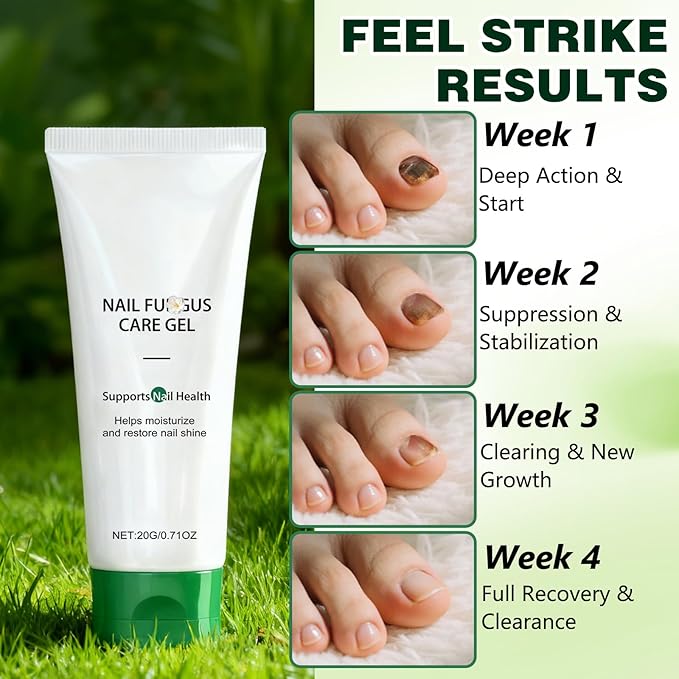 2PCS Nail Repair Gel, Nail Growth Repair Cream, New Multi-Purpose Nail Repair, Foot Care Cream for Moisturizing and Repairing Feet