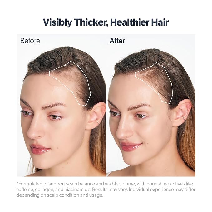 SUNGBOON EDITOR Deep Collagen Retinol Scalp Serum |Roll-On Hair Growth&Thickening Serum |Dry, Itchy Scalp Treatment |Caffeine +Biotin +Rosemary |Stocking Stuffers for Women |Korean Hair Care,0.5 fl oz