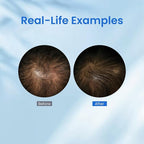 0.5% KX-826 Hair Growth Spray DHT Blocker Hair Thickening Regrowth Treatments,Oil Control Hair Loss Reduction 3-6 Months New Hair Visible,Hair Growth Products Men&Women-3 Month Supply 180ml