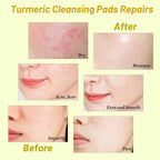 120 pads turmeric cleansing pads