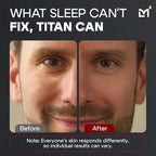 Titan Peptide Anti-Aging Under Eye Gel for Men – Reduce Appearance of Puffiness, Dark Circles, Eye Bags, & Sagging – DMAE, Niacinamide, Hyaluronic Acid, Peptides – All Skin Types – Unscented