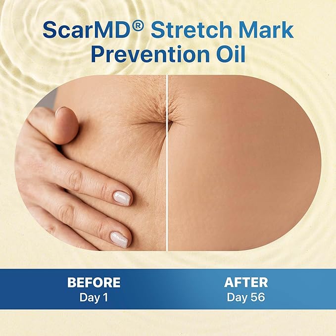 Stretch Mark Oil, Minimizes the Risk and Severity of Stretch Marks, Gentle Belly Oil for Pregnancy, Made of Natural Ingredients, Suitable for Adults and Children, 120mL（4.06 Fl Oz）