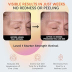 Fig.1 Retinol Night Cream Refill | Face Hydrating Moisturizer With Retinol & Squalane | Night Cream For Women With Sensitive Skin | Dermatologist Tested Wrinkle Reduction | 50ml