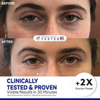 Peptide Cooling Under Eye Patches, Soothing Eye Patches Instant Reduces Dark Circles and Puffiness, Calming Under Eye Mask with Glacial Water for Bags Treatment, 12 Pairs