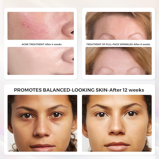 QuasarMD 3D LED Face Mask with Gold-Wire LEDs, Red & Infrared Light for Wrinkles, Blue Light Mode for Blemish Care, Advanced Light Therapy for Skin Rejuvenation & Radiant Look