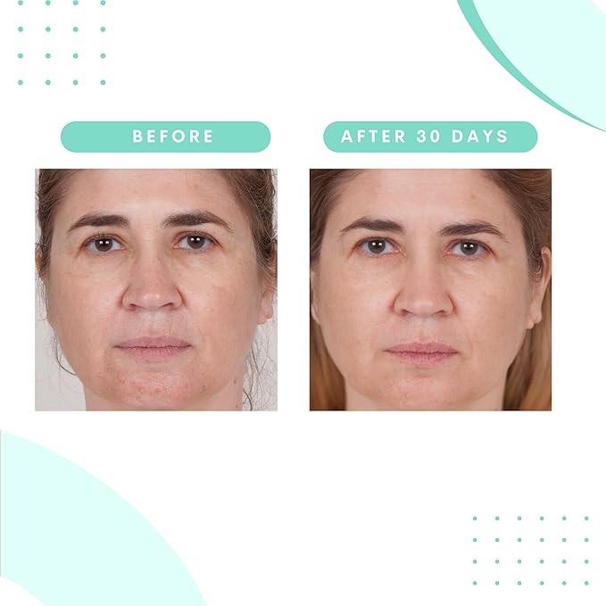 Serious Skincare - Glycolic Facial Moisturizer Cream for Hydration & Exfoliation, Texture Refining for Lines, Wrinkles, Pores, Face Discoloration, Skin Balancing Blue Tansy - Anti-Aging, 1.7 Fl. Oz.