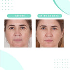 Serious Skincare - Glycolic Radiant Skin Set - Improve Appearance of Lines, Wrinkles and Enlarged Pores - Face Wash Cleanser, Gommage Exfoliating Clay Mask & Retexturizing Treatment Pads (3piece)