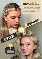 I DEW CARE Dry Shampoo Powder - Tap Secret Orignal + Refill 2 Pack | With Black Ginseng, Non-aerosol, Benzene-free, Mattifying Root Boost, No White Cast, Travel Size, Hair Volume