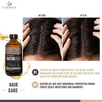 CARAWAY Cold Pressed Pure Castor Oil – Indian Handmade | Therapeutic Grade | Edible | For Liver Detox, Hair Growth, Eyelashes, Skin, Constipation & Joint Pain | Glass Bottle – 236ml