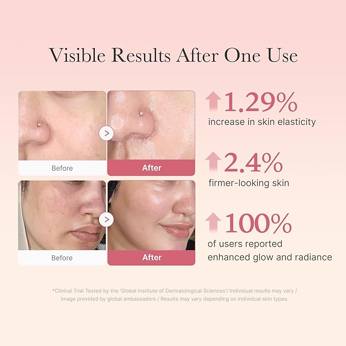 medicube Pink Skincare Set for Glass Glow Skin: Age-R Booster Pro Pink | 6-in-1 Real Glass Glow Beauty Massager and Collagen Jelly Cream- Niacinamide & Freeze-Dried Hydrolyzed Collagen 110ml