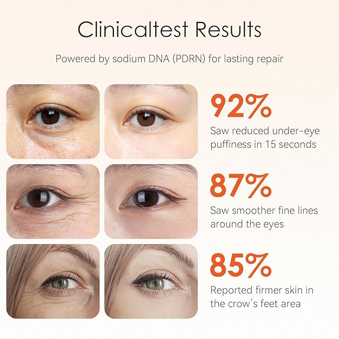 15-Second Instant Eye Lift Cream with Sodium DNA & 0.1% Retinal | Rapid Tightening for Eye Bags & Fine Lines | Dual-Action Firming + Long-Term Repair | Caffeine, Peptides & Collagen Complex | 0.7fl oz