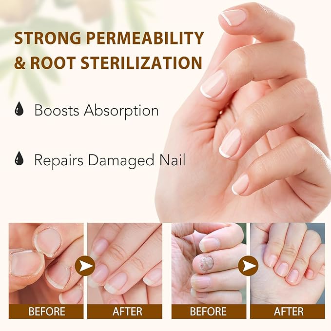 2PCS Ginger Nail Treatment, Nails Growth Serum, Nail Repair Cuticles Oil, Ginger Nail Serum Oil for Strengthen nails & Promote Nail Growth, Natural Plant Formula