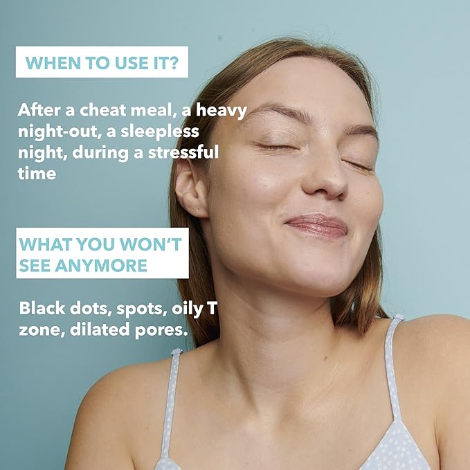 RARE Paris - Carbone Glacé - Purifying Carbon Black Facial Sheet Mask - Cleanses & Tightens - With Hamamelis & Mallow - Purifying, Firming & Revitalizing - Multi-Active Serum Formula - 1 Pack