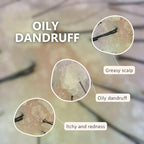 Aromase Oily Scalp Balancing Shampoo (Ideal for oily scalp with dandruff) 14 FL OZ