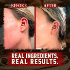 Organic Beef Tallow for Skin - 4 OZ (Pack of 3) — Grass Fed Beef Tallow for face + Body — US-Made Whipped Tallow and Honey Balm Moisturizer for Dry and Sensitive Skin, Eczema, Rosacea (No Additives)