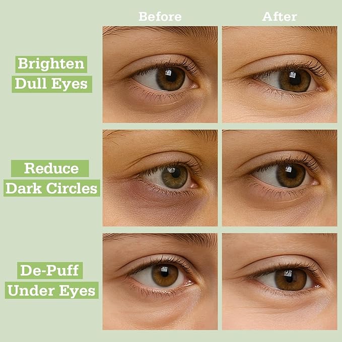 Matcha Hydrogel Under Eye Patches 28 Pairs Antioxidant Green Tea Eye Mask for Puffy Eyes and Dark Circles 5 Minute Cooling Hydration Under Eye Treatment Ophthalmologist Tested