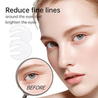 Novoy 7 Pairs Bio-Collagen Real Deep Eye Patches - 6-in-1 Retinol Overnight Eye Patches for Dark Circles, Puffiness & Wrinkles | 2% Caffeine+Hyaluronic+Niacinamide, Korean Popular Eye Mask - ROSE