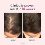 Trybello Hair Growth & Anti-Stress Gummies for Women | Powered by AnaGain — Plant-Based Biotin | Sugar-Free, Vegan Hair Supplements | Gluten-Free Gummy Vitamins for Thicker Healthier Hair | 60 Gummies