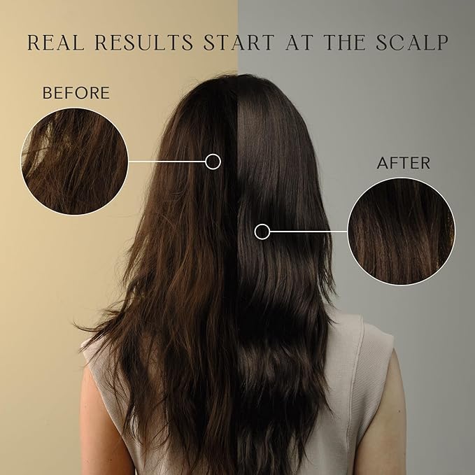 KIWABI ROOT BEAUTÉ Scalp Conditioner – Hair Growth & Scalp Treatment for Thinning, Dry & Oily Scalp – Sulfate-Free Hair Conditioner for Women with 23 Botanicals for Lustrous & Healthy Hair