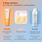 Folliculitis Acne Lotion for Body: Helps Reduce Itch, Redness, Body Acne, Bumps & Uneven Texture with Salicylic & Glycolic Acid + Botanicals - Gentle Care for Folliculitis-Prone Skin