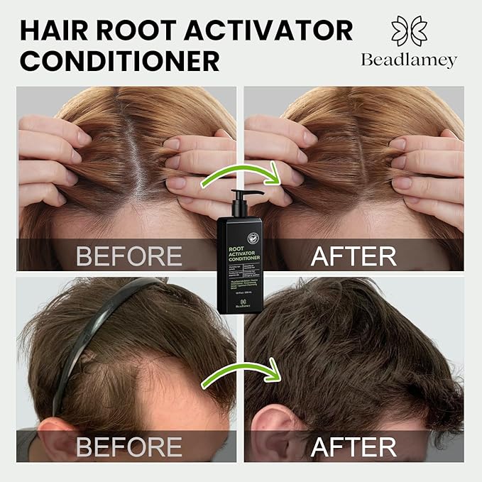 Root Activator Conditioner for Men and Women: Hair Growth Conditioner for Hair Loss and Thinning Hair - Smoothes, Nourishes & Fortifies Hair for Healthier Look- 10.1 fl oz / 300 mL