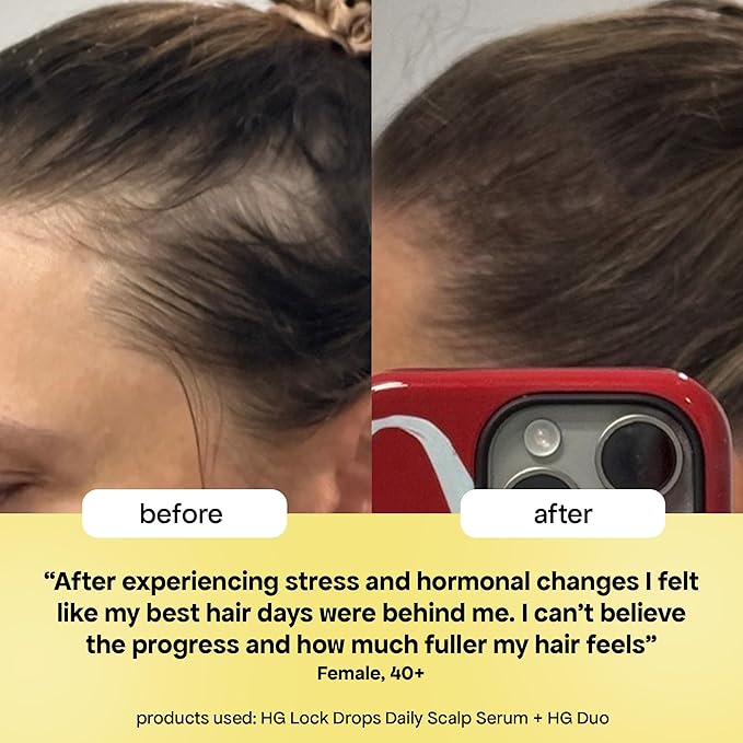 BondiBoost HG Lock Drops Daily Hair Serum (60ML) – Non-Greasy, Reduces Hair Thinning, Stimulates Scalp, Supports Thicker Fuller Hair – Vegan, Color-Safe, Lightweight for All Hair Types & Textures