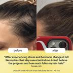 BondiBoost HG Lock Drops Daily Hair Serum (60ML) – Non-Greasy, Reduces Hair Thinning, Stimulates Scalp, Supports Thicker Fuller Hair – Vegan, Color-Safe, Lightweight for All Hair Types & Textures