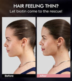 Dual Essence Hair Growth Shampoo and Conditioner Set with Biotin&Tripeptide, 3X Moisturizing Biotin Shampoo for Softer Shiner Hair, Anti-Loss Dandruff Routine Rosemary Shampoo for Men Women, 2x16.9oz