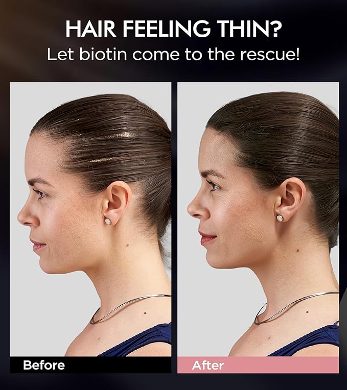 Dual Essence Hair Growth Shampoo and Conditioner Set with Biotin&Tripeptide, 3X Moisturizing Biotin Shampoo for Softer Shiner Hair, Anti-Loss Dandruff Routine Rosemary Shampoo for Men Women, 2x16.9oz