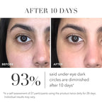 Algenist Triple Algae Eye Renewal Balm - Hydrating Vegan Eye Cream with Caffeine, Alguronic Acid & Vitamin E to Help Reduce Dark Circles, Puffiness, Fine Lines & Wrinkles - Travel Size (0.5 oz)