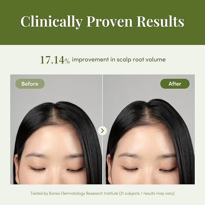 CURLYSHYLL Revitalizing Ampoule | Scalp Serum for Thinning Hair & Sensitive Scalp | Lightweight Daily Use | 50ml