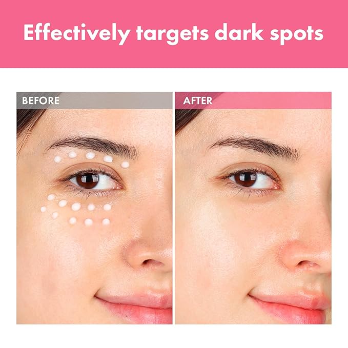 TOSOWOONG Arbutin 7% Intensive Spot Cream with 70,000ppm Arbutin, 3% Tranexamic Acid, 1% Niacinamide, Glutathione, Dark Spots, freckle, Blemishes, Anti-pigmentation, Korean Skin Care, 20ml, 0.67 fl.oz