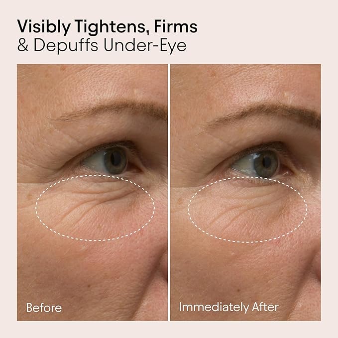 Alpyn Line-Filling Eye Balm with Bakuchiol & Caffeine, Reduce the Look of Fine Lines & Wrinkles, Minimize the Appearance of Puffiness & Target Dark Circles, 0.5 oz / 14 ml