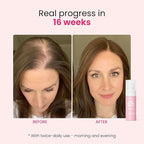 Trybello Hair Helper Spray - Hair Growth Serum with Biotin & Castor Oil - Caffeine Infused Hair Treatment for Thicker, Fuller Hair - Repair Thinning Hair Naturally - Vegan, Cruelty-Free Formula, 4Pack