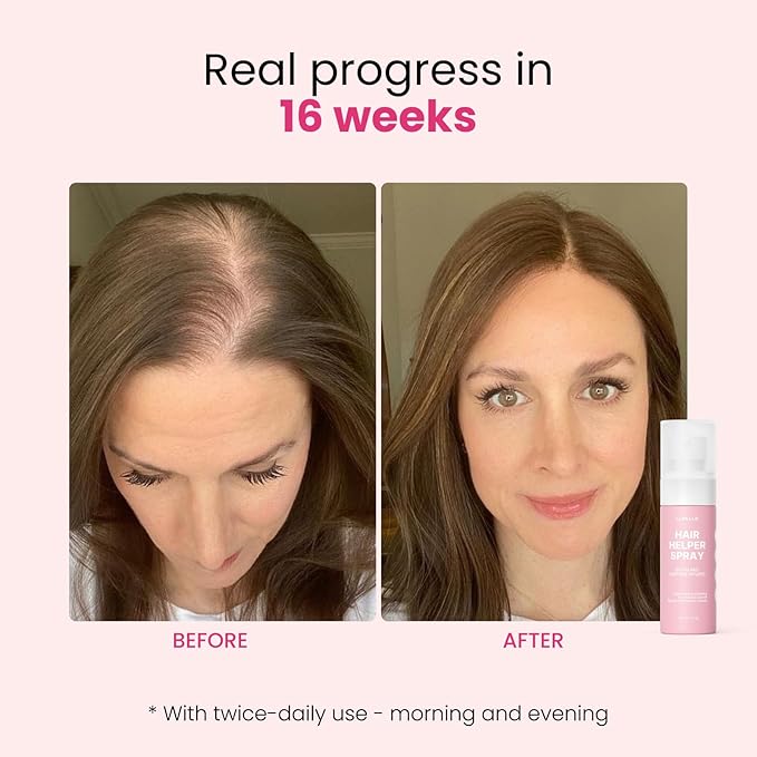 Trybello Hair Helper Spray - Hair Growth Serum with Biotin & Castor Oil - Caffeine Infused Hair Treatment for Thicker, Fuller Hair - Repair Thinning Hair Naturally - Vegan, Cruelty-Free Formula, 4Pack