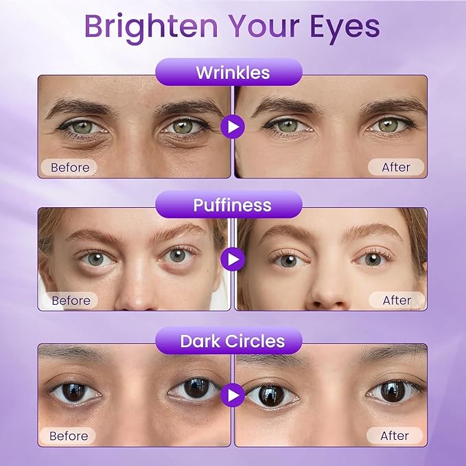 Retinol Under Eye Cream for Dark Circles & Puffiness – Anti-Aging Eye Cream for Fine Lines & Wrinkles, Hydrating Under Eye Cream for Men & Women, 1.06 Fl Oz