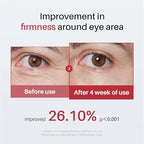 Caffeine & Retinol Eye Serum for Dark Circles, Puffiness and Wrinkles, Under Eye Cream with Hyaluronic Acid, Niacinamide & Peptides, Roller Serum with 360°Massage Ball - 0.5 fl. oz