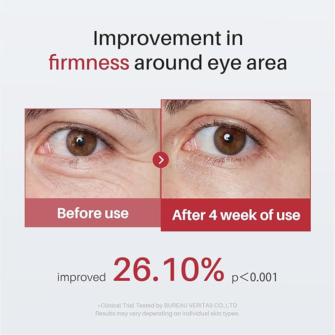 Caffeine & Retinol Eye Serum for Dark Circles, Puffiness and Wrinkles, Under Eye Cream with Hyaluronic Acid, Niacinamide & Peptides, Roller Serum with 360°Massage Ball - 0.5 fl. oz