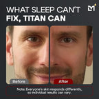 Titan Anti-Aging Mens Eye Cream – Mens Dark Circles Under Eyes Treatment – Eye Bags Treatment for Men – Puffy Eyes Treatments for Men – Peptides, HA, Herbal Extracts –All Skin Types–Unscented