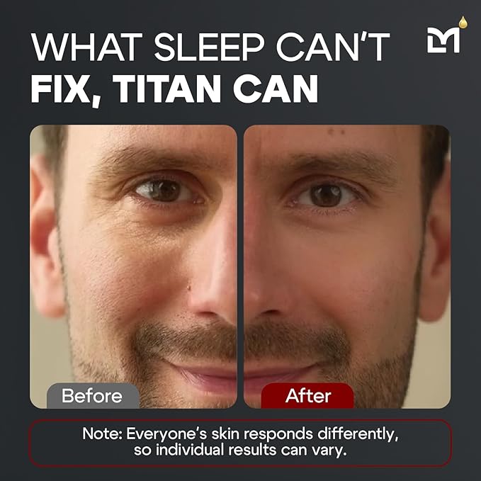 Titan Anti-Aging Mens Eye Cream – Mens Dark Circles Under Eyes Treatment – Eye Bags Treatment for Men – Puffy Eyes Treatments for Men – Peptides, HA, Herbal Extracts –All Skin Types–Unscented