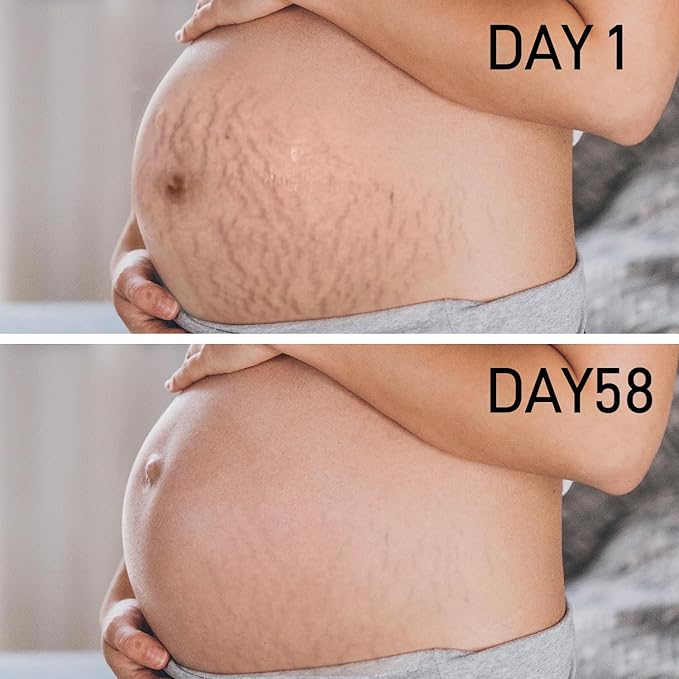 PEGO Stretch Mark Oil for Pregnancy, Maternity Body Oil for Stretch Mark Prevention & Reduction, Hydrating Skin Care, 2.03oz (1Pack)